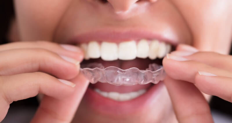 Retainer